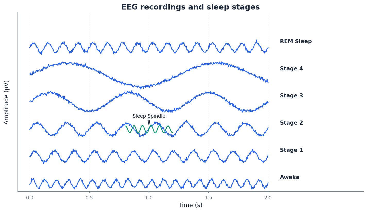 EEG recordings and sleep stages.
